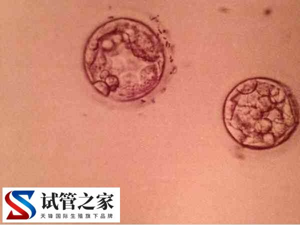 4ab囊胚和5ab囊胚谁更好(图1)